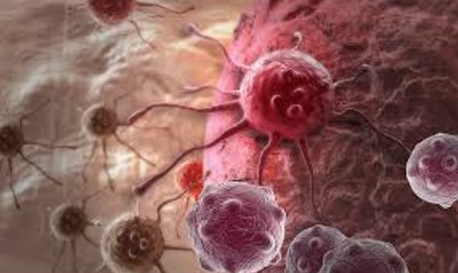 Пораженная раком клетка